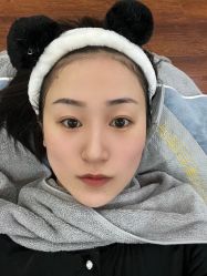 体验前-沈阳名流美容医院