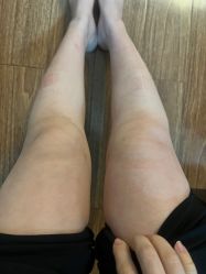 体验后-洁铭新加坡医美