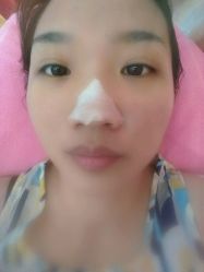 -成都苗方清颜专业祛痘