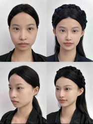 -Yestar重庆艺星医疗美容医院