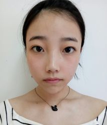 点击看大图 体验前-鑫元辰医疗美容整形