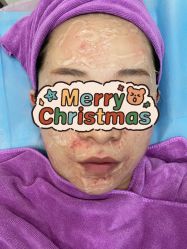 体验后-北京米扬丽格医疗美容·联合丽格鼻整形中心