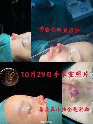 -深圳美莱医疗美容医院