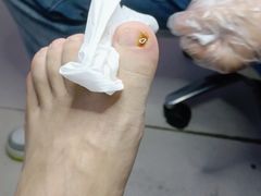 -新甲连锁灰指甲·甲沟炎·鸡眼(黑龙江路店)