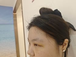 -长沙雅美医疗美容医院