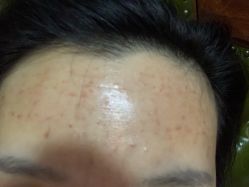 体验后-天津伊美尔医疗整形美容专科医院
