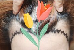 -大麦微针植发全国连锁