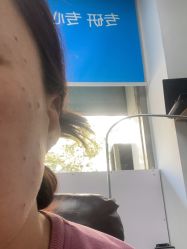 -百年美肤堂祛痦痣祛斑祛疣