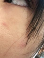 -丽美妍医疗美容·皮秒·立体分层抗衰