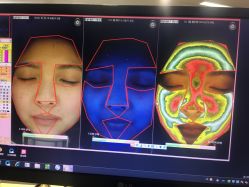 皮肤检测-光SPA科技美肤