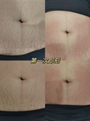 -杭州医巢医疗美容