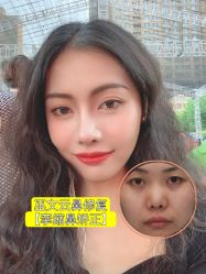 -北京米扬丽格医疗美容·联合丽格鼻整形中心