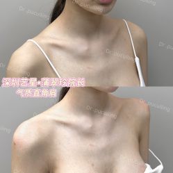 -深圳艺星医疗美容医院
