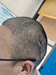 -雍禾植发