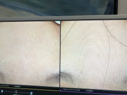 -苑苑vbeauty科技美容SPA