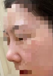 点击看大图 体验后-上海首尔丽格医疗美容医院