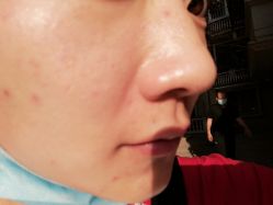 -VE专注问题肌·赛诺龙&科学美肤中心
