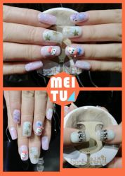 iphone_upload_pic-光SPA科技美肤