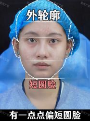 点击看大图 -Yestar重庆艺星医疗美容医院