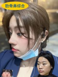 -素美医疗美容·西南眼鼻整形·修复基地