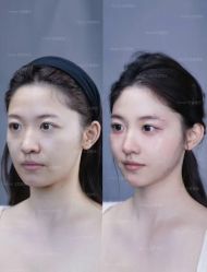 -Yestar艺星医疗美容医院