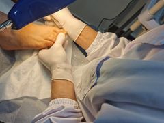 -世龙世家灰指甲鸡眼脚气甲沟炎跖疣护理(通州店)