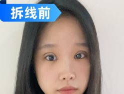 -素美医疗美容·西南眼鼻整形·修复基地