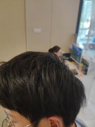 -大麦微针植发丨全国连锁