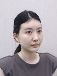 体验前-深圳艺星医疗美容医院