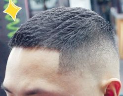 -大麦微针植发丨全国连锁