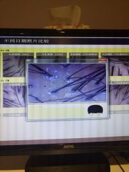 -菩叶头皮抗衰养发护发