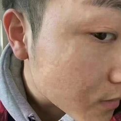 -蕾特恩专业祛痘·皮肤管理