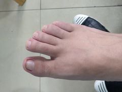 -世龙世家灰指甲·甲沟炎·跖疣护理·修脚(东江湾路店)