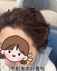 -大麦微针植发丨全国连锁