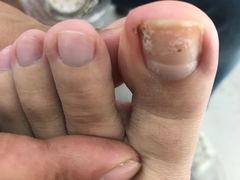 -新甲连锁灰指甲·甲沟炎·鸡眼(黑龙江路店)