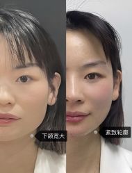 -上海伊莱美医疗美容医院