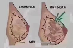-香薇妮丝女子减肥院