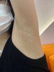 -MUSES专业脱毛比基尼サロン日式连锁