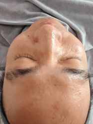 -SKIN79皮肤管理中心