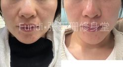 -Fundi张玉珊修身堂·indiba·BTL科技瘦身
