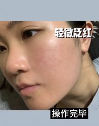 体验后-南宁华美医疗美容医院