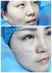 -尚玲纹绣纹眉特价店