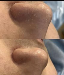 -SKIN79皮肤管理中心