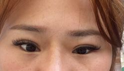 体验后-天津伊美尔医疗整形美容专科医院