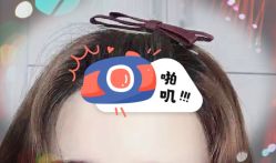 -大麦微针植发全国连锁