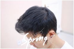 体验后-大麦微针植发全国连锁