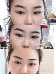 -久匠半永久纹眉