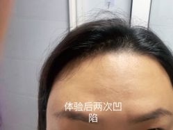 体验后-西安伊美尔医疗美容医院