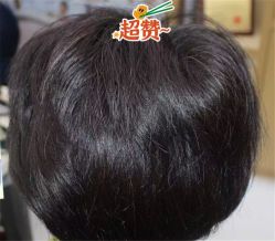 -大麦微针植发全国连锁
