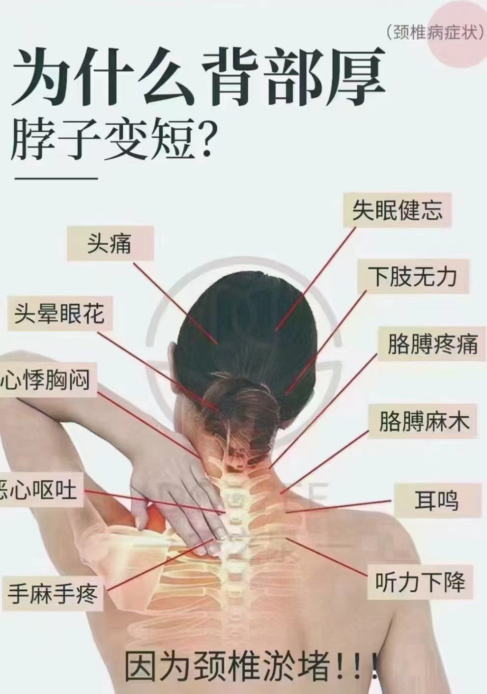 97 为什么背部变厚,脖子变短?因为颈椎